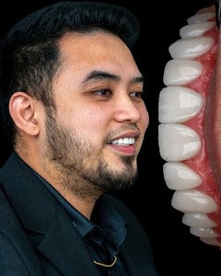 Veneers case 2 patient portrait