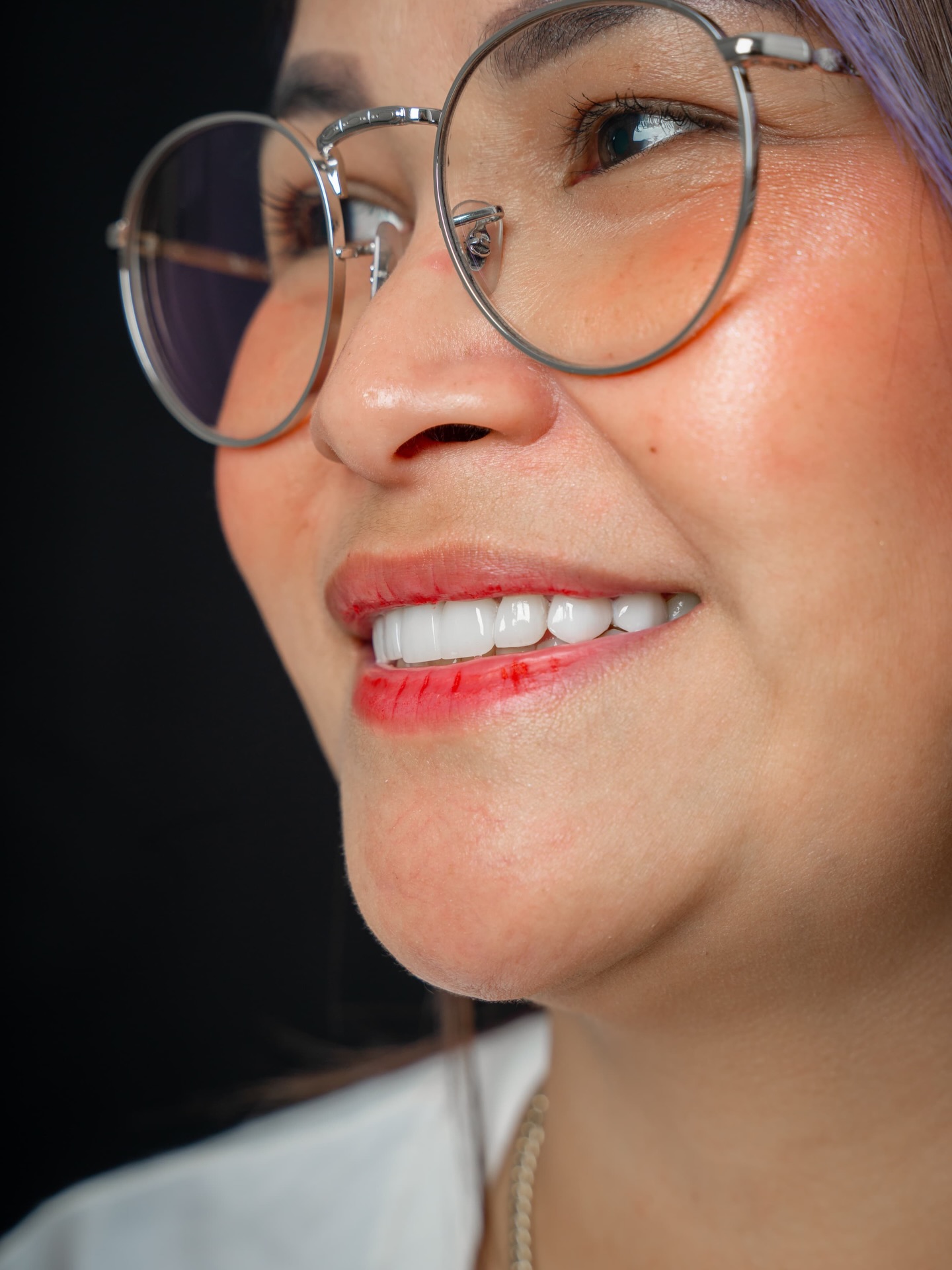 Veneers case 6 patient portrait